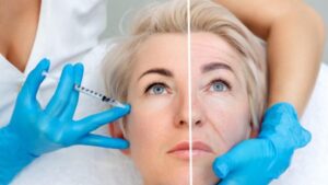Buy dermal fillers online – Certified dermal fillers for professional aesthetic clinics